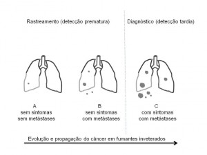 Diagram showing the spread of lung cancer
